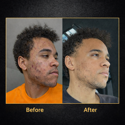 Organic Grass Fed Beef Tallow Balm With Raw Honey